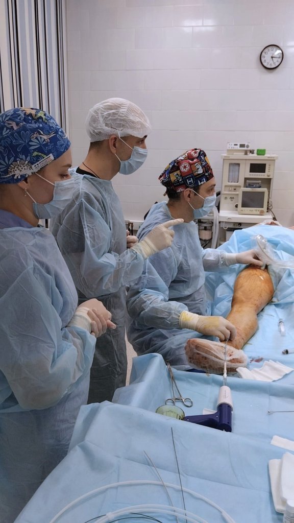 Клеевая облитерация Подольск